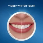 Crest Teeth Whitening Strips Visibly Whiter Teeth Illustration