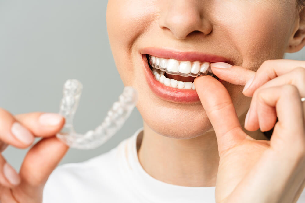 Woman Using Teeth Whitening Gel